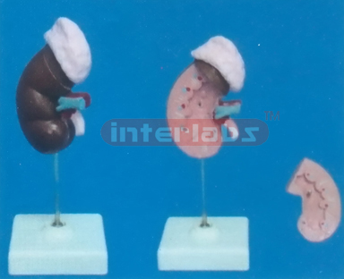 NATURAL RIGHT KIDNEY WITH ADRENAL GLAND (2 PCS) ON BASE 6.5cm LONG